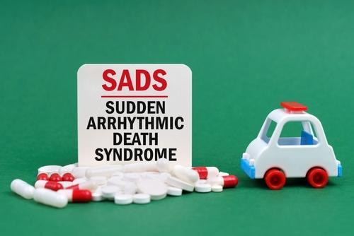 Sudden Arrhythmic Death Syndrome