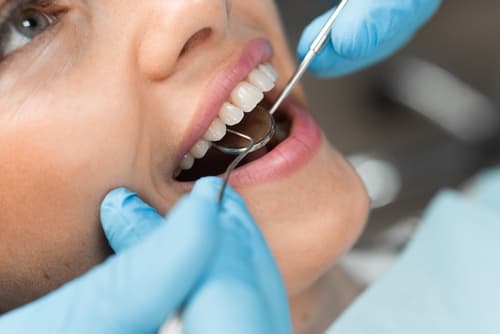 Close-up,Of,A,Girl's,Smile,,Oral,Diagnostics,By,A,Dentist Dental